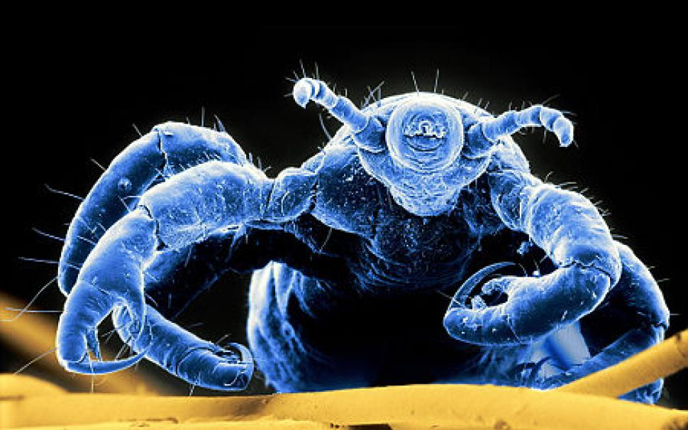 Maryland Outbreak of Super Lice